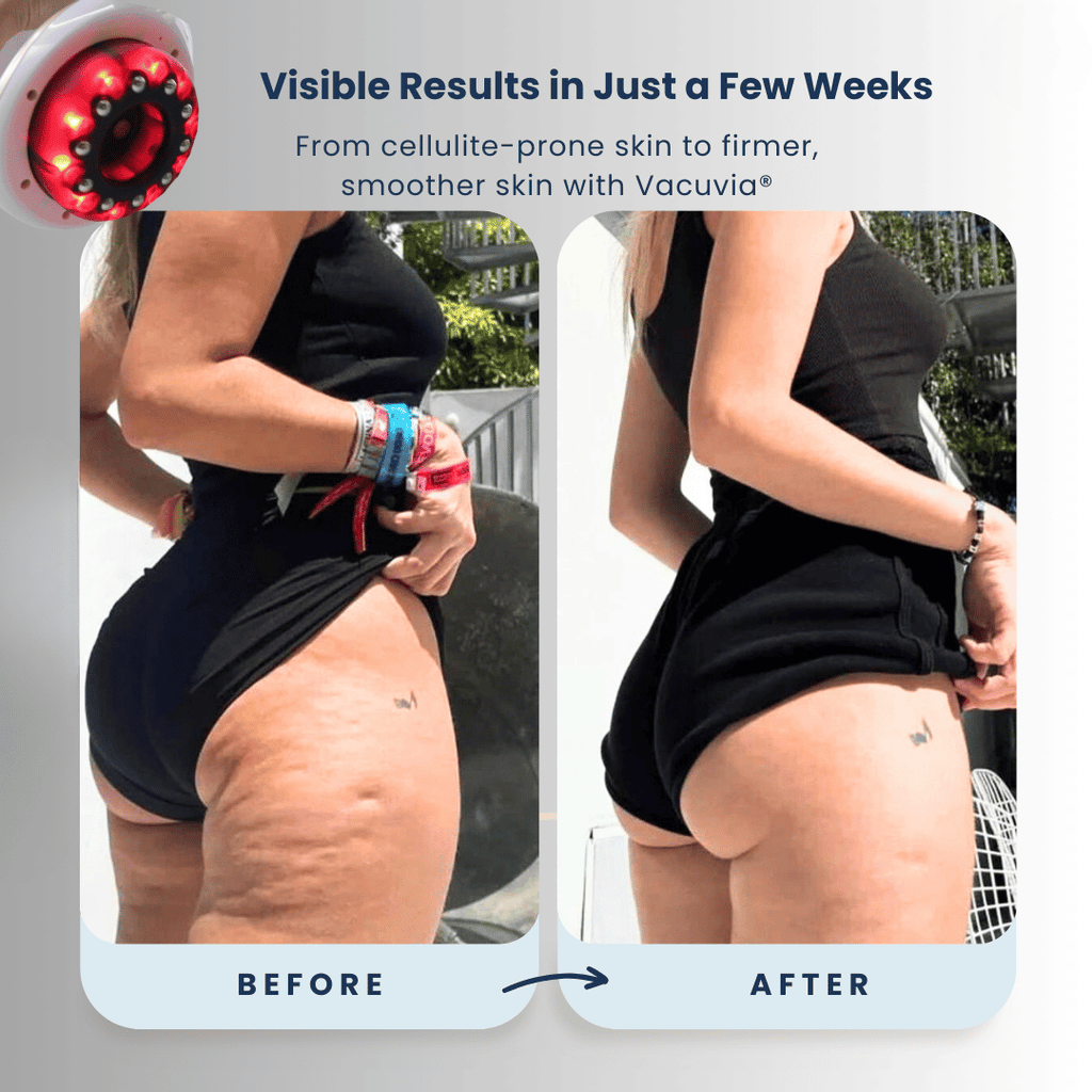 ScluptGlow For Firmer, Toned Skin