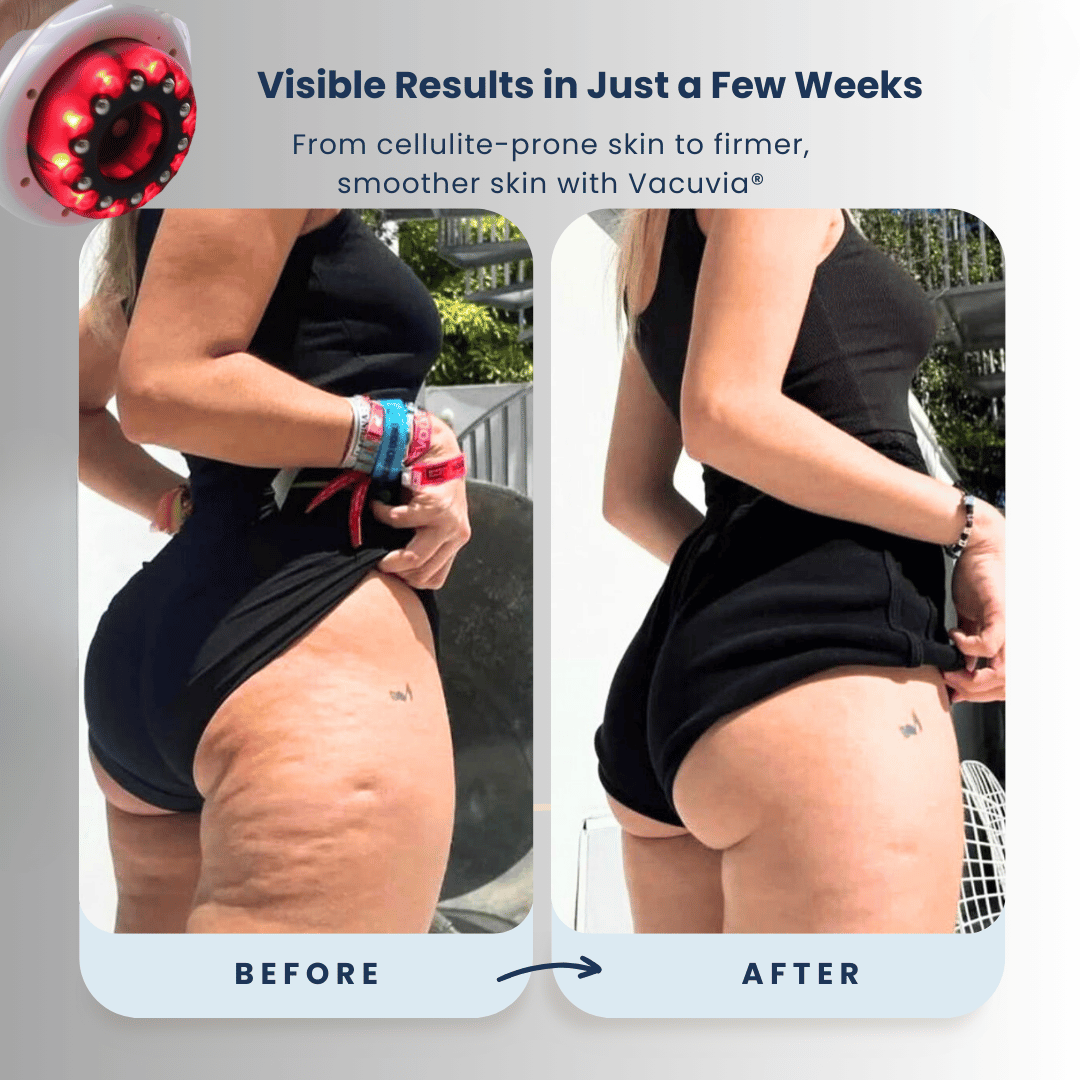 ScluptGlow For Firmer, Toned Skin